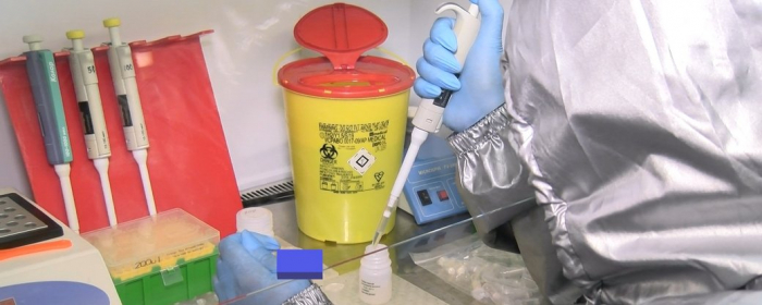 Майже 100 нових випадків COVID-19 зафіксували за минулу добу на Закарпатті