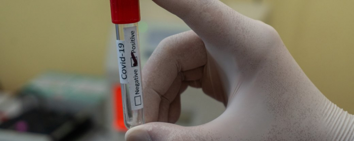 Закарпаття: 22 нові випадки COVID-19 підтвердили впродовж доби