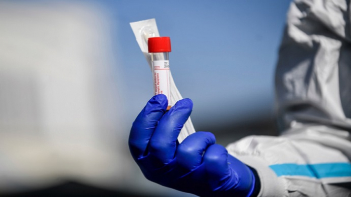 За минулу добу  в Ужгороді виявлено 4 нові випадки коронавірусної інфекції