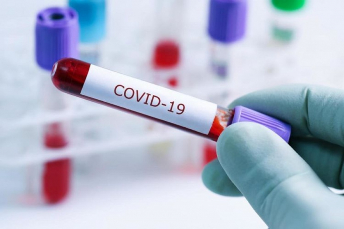 COVID-19 на Закарпатті: 292 нових випадки, 4 хворих померло