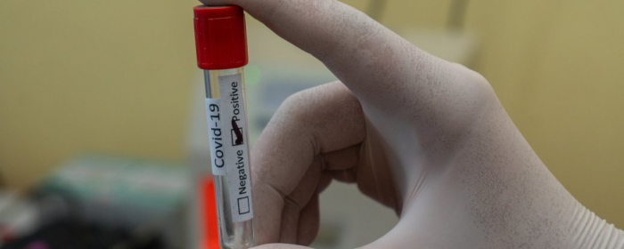 На Закарпатті за добу COVID-19 виявили у 787 людей, померли 10 хворих