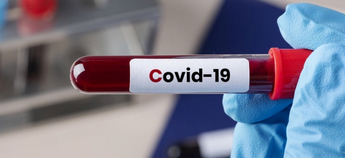 У 12 закарпатців виявили COVID-19