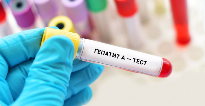 В Ізі погіршилася епідситуація з гепатитом А - запровадили додаткові обмежувальні заходи