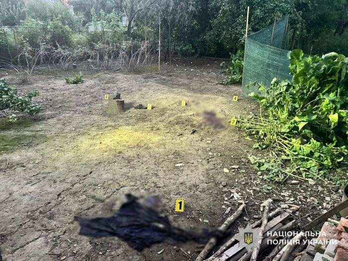 На Мукачівщині внаслідок вибуху гранати тяжко травмований підліток: поліція встановлює обставини

