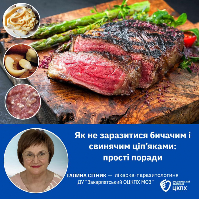 На Закарпатті зареєстровано випадок теніаринхозу: що варто знати про «непроханих гостей» у вашому організмі?

