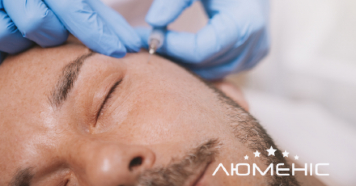 Чому не можна вирізати або «перев’язувати» папіломи самостійно: основні ризики та можливі ускладнення