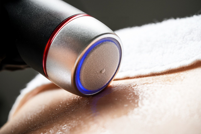 RF-ліфтинг і кріотерапія: поєднання, що омолоджує та підтягуює шкіру