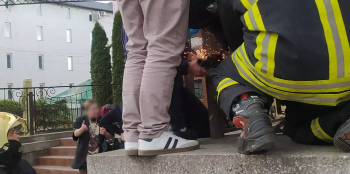 У селищі Воловець рятувальники надали допомогу дитині, яка травмувалася