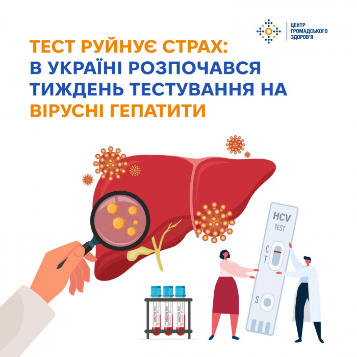 Тиждень тестування на гепатити: жителі Закарпаття можуть безоплатно пройти експрес-тест