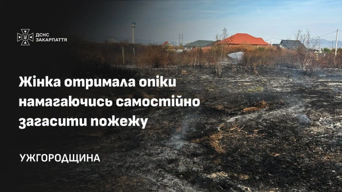 На Ужгородщині жінка отримала опіки рук та ніг, намагаючись самостійно загасити пожежу