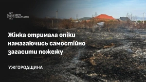 На Ужгородщині жінка отримала опіки рук та ніг, намагаючись самостійно загасити пожежу